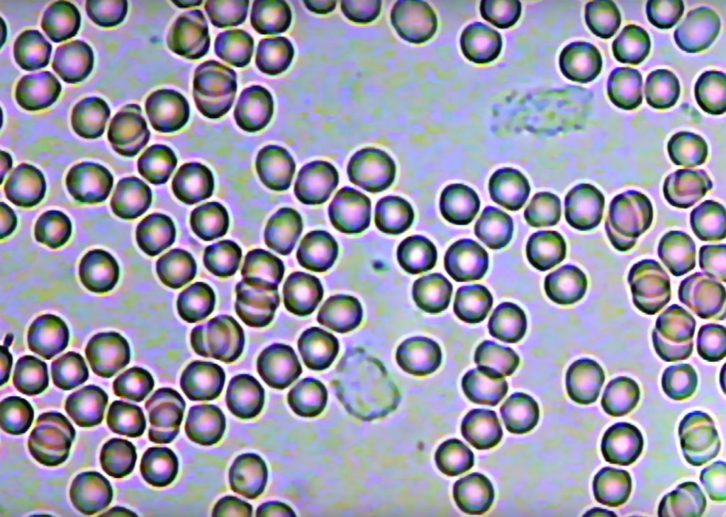 гемосканирование как в норме выглядит кровь под микроскопом