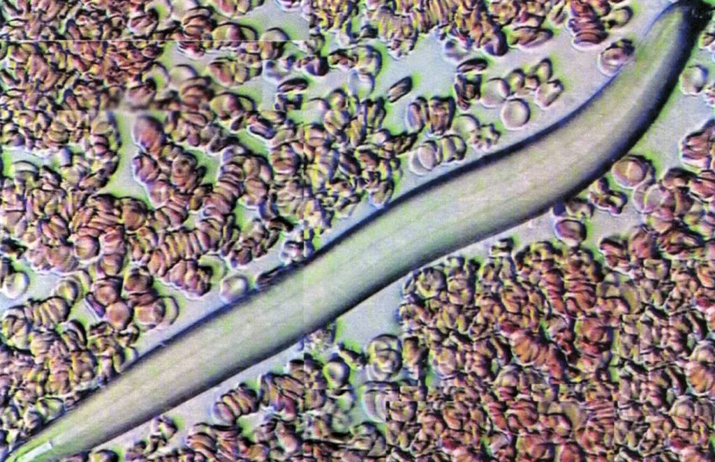 анализ периферической крови: Личинка огромного паразита