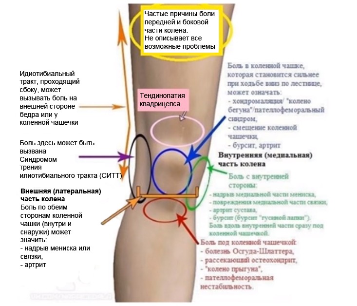 причины боли колена. спортивные патологии коленного сустава. беговые травмы