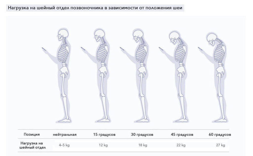 нагрузка на шейный отдел позвоночника в зависимости от положения шеи